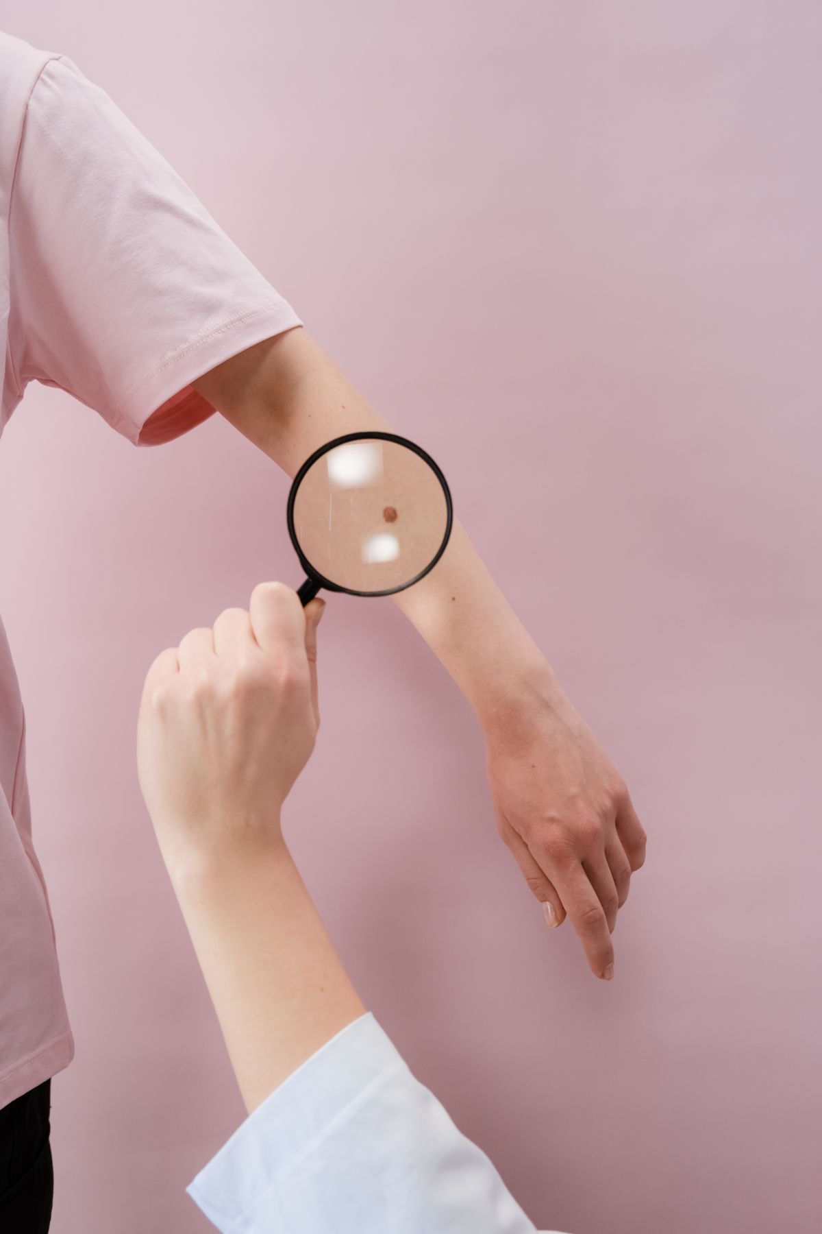 Pigmentation